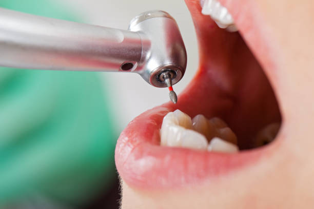 Best Mobile Emergency Dentist in Grovetown, GA